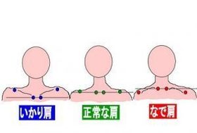 肩タイプ.jpg